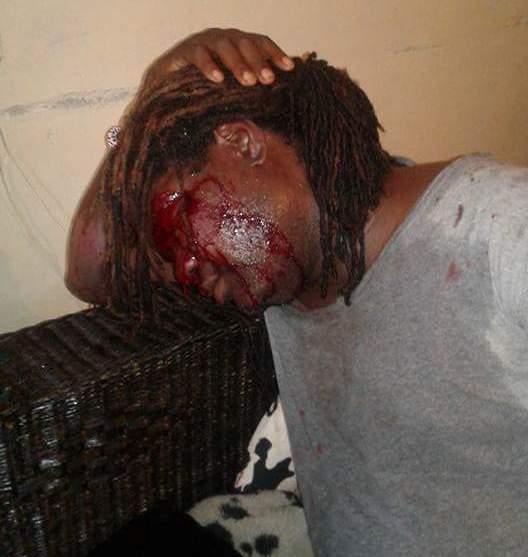 Man beaten for 'being gay' in Malawi