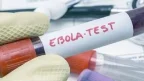 Lab tests show Karonga man did not have Ebola- Malawi24