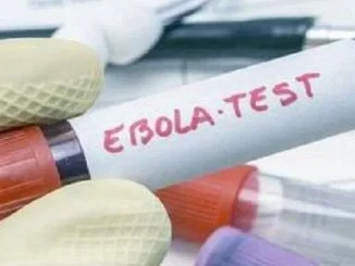 Lab tests show Karonga man did not have Ebola- Malawi24