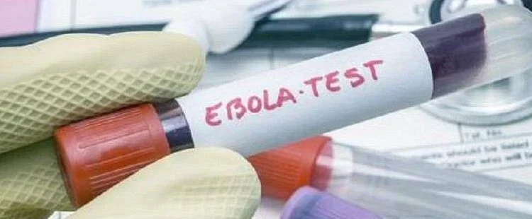 Lab tests show Karonga man did not have Ebola- Malawi24