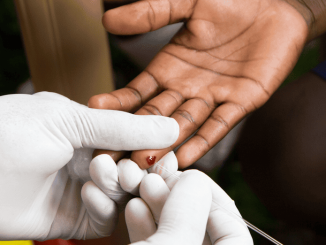 HIV-testing