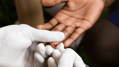 HIV-testing