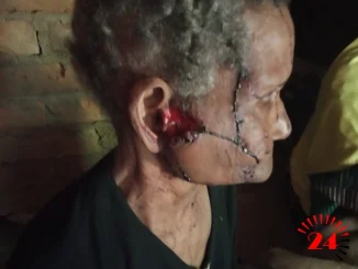 Assaulted Woman- Malawi24