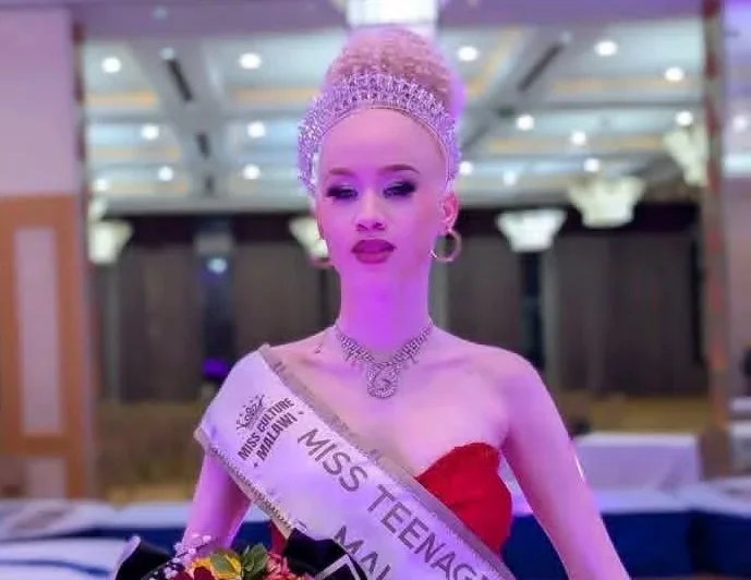 Miss Teen Universe Malawi Seeks K10 Million for Cambodia Trip